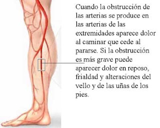 La composición de la crema de varikoza veins