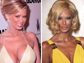 Jenna Jamison Plastic Surgery on Jenna Jameson With Plastic Surgery