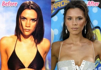 celebrity plastic surgery celebrity plastic surgery