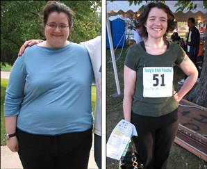 After surgery, the now 140 pound 5'7 young woman has cut all of her health After surgery, the now 140 pound 5'7 young woman has cut all of her health