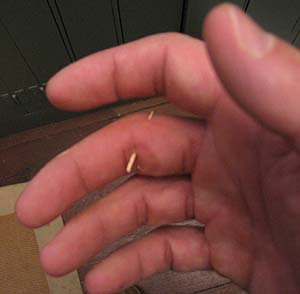 splinter.jpg