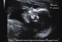 Mariana - com 21 semanas