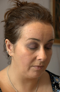 The New Botox Everyone is Having, But Would You pics The New Botox Everyone is Having, But Would You pictures