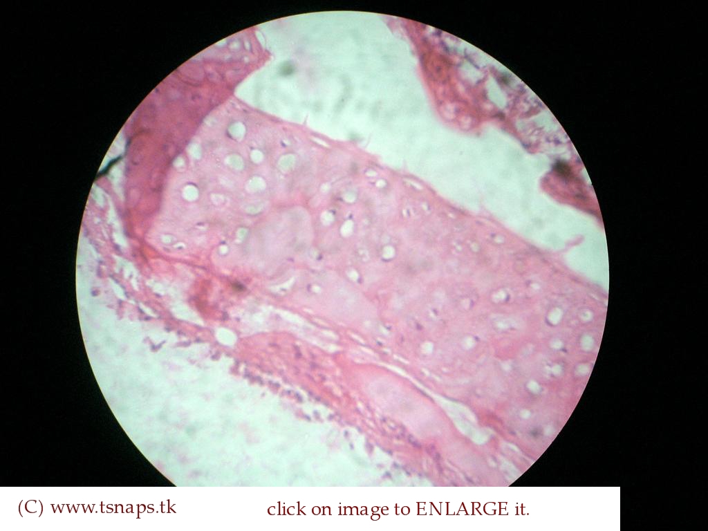 trachea histology
