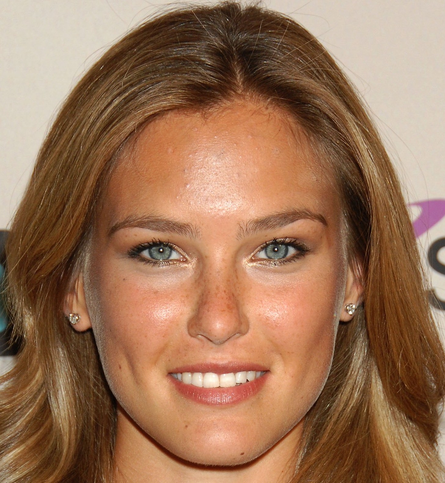 http://2.bp.blogspot.com/_bQ0SqifjNcg/S9h-aDRXqUI/AAAAAAAAT2Q/Yvn_X_EqFGw/s1600/bar-refaeli-acne-2.jpg