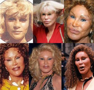 Jocelyn Wildenstein before and after photo of plastic surgery