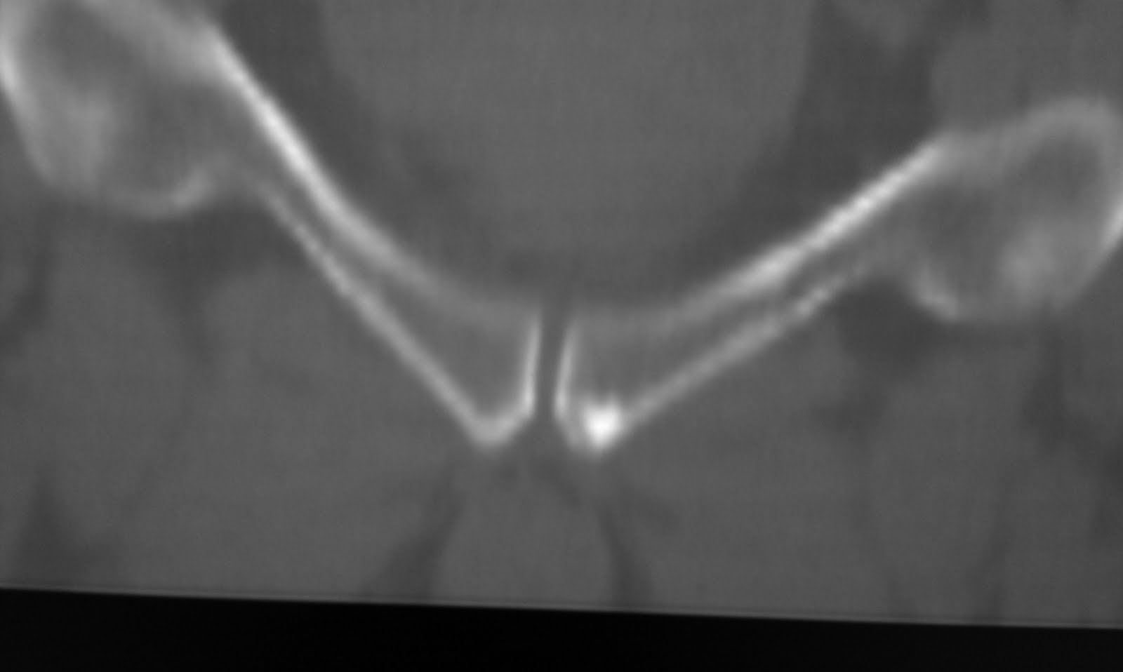 Daily Dose Bone island