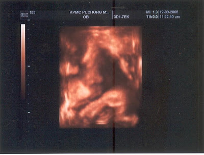 Damia Dean June 2007