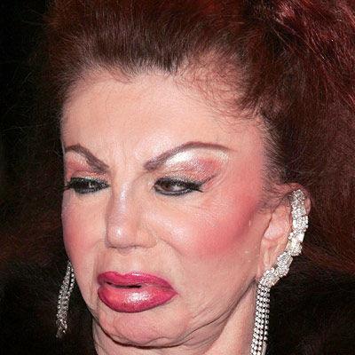 http://2.bp.blogspot.com/_bqPTsokM40I/TP3dnXe2nSI/AAAAAAAABwc/2dXeFtxQ6Qo/s1600/horreur-chirurgie-jackie-stallone.jpg