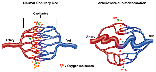 Capillary Network