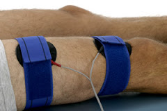 ELECTROESTIMULACIÓN (GIMNASIA PASIVA) DE CUÁDRICEPS