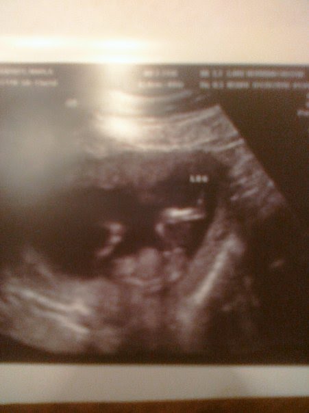 14 weeks