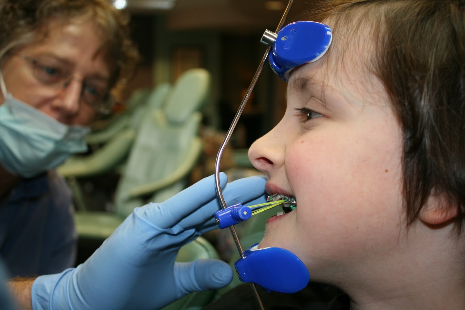 A Day in the Life Brace Face (Phase One)