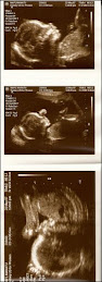 Ultra sound picture of baby Rosario