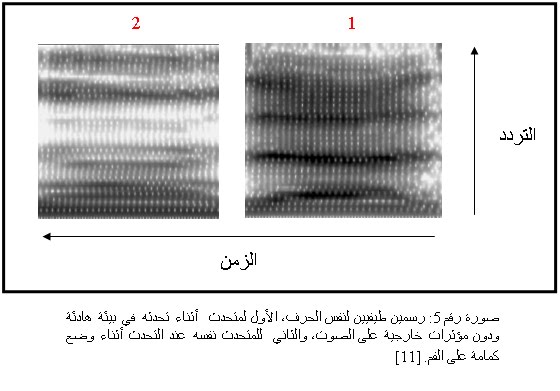 [ultrasound_two.jpg]