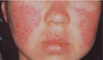 نقره لتكبير أو تصغير الصورة ونقرتين لعرض الصورة في صفحة مستقلة بحجمها الطبيعي