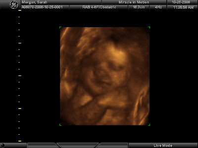 3d ultrasound pictures of twins. images 3d ultrasound 20 weeks