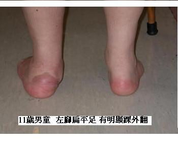 [Flat+Foot+post+view..jpg]