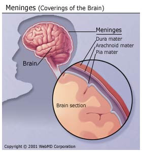 http://2.bp.blogspot.com/_czelW1e6PzQ/SepsEmN_E-I/AAAAAAAAB6M/GhRHoIMe8UQ/s320/meningitis.jpg