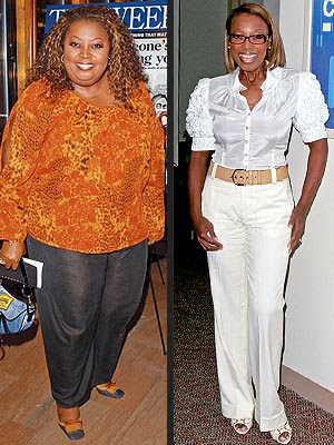 star jones before and after surgery