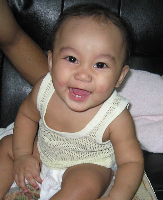 He shows a pouting face when teething rash on face pictures. He shows a pouting face when