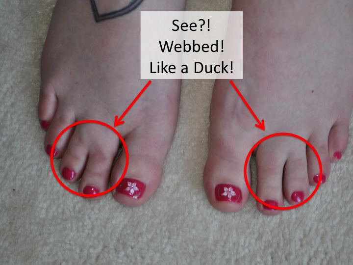 human webbed feet human webbed feet