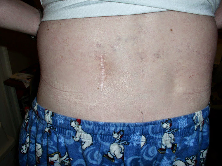 MY GOLDENHAR PICTURES - SURGERY SCARS