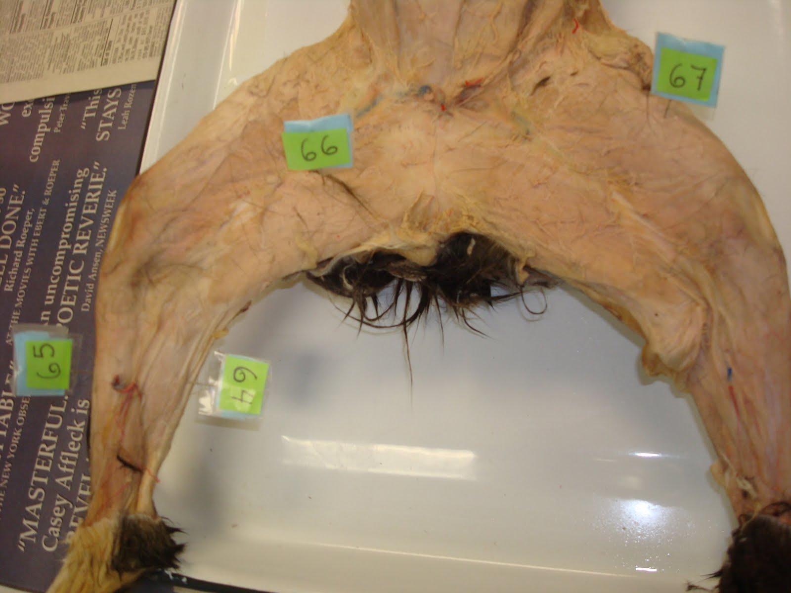 Resendiz Human Anatomy @ LASC