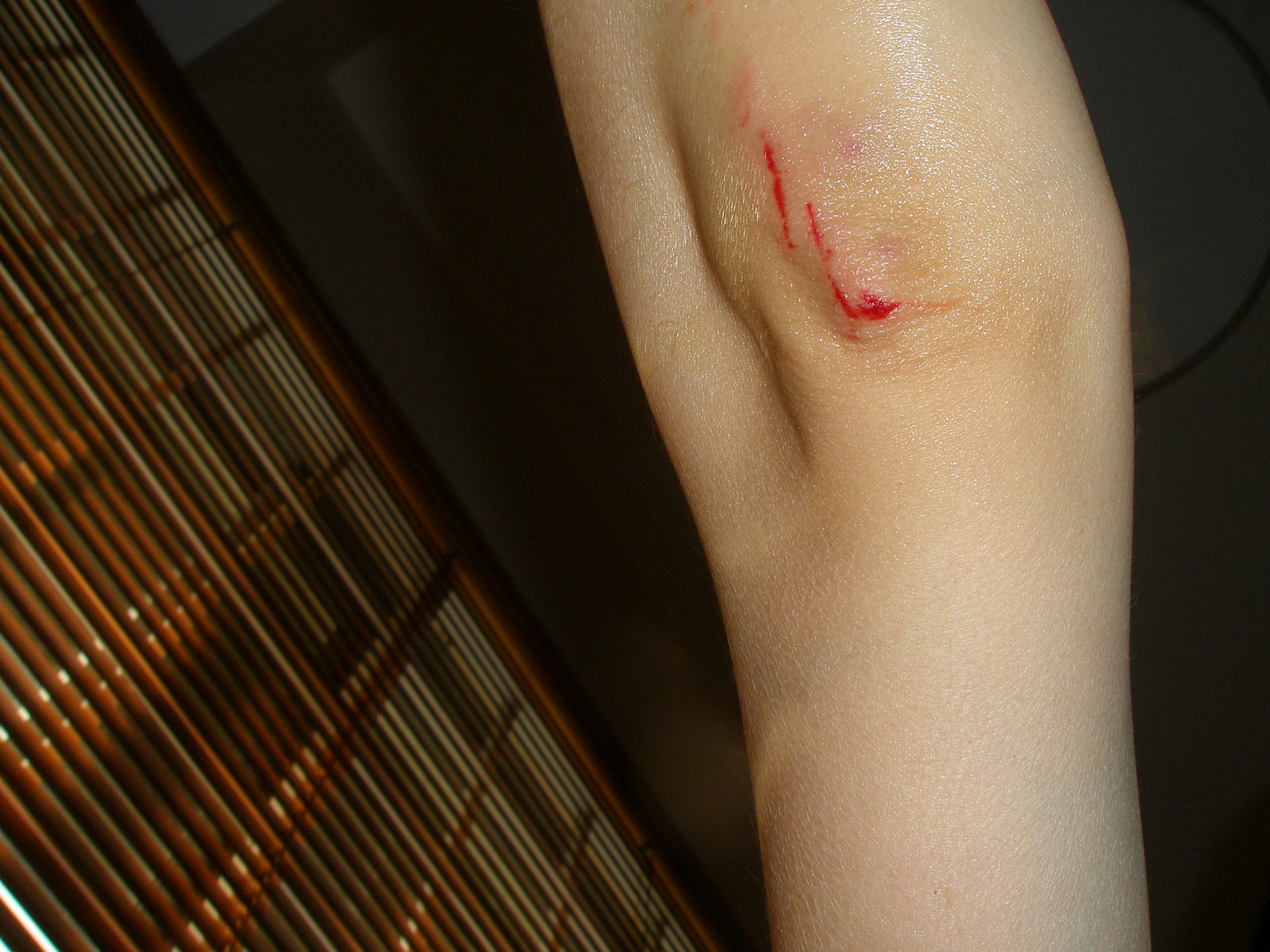 [Accident,+putting+marbles+in+fountain+034.jpg]