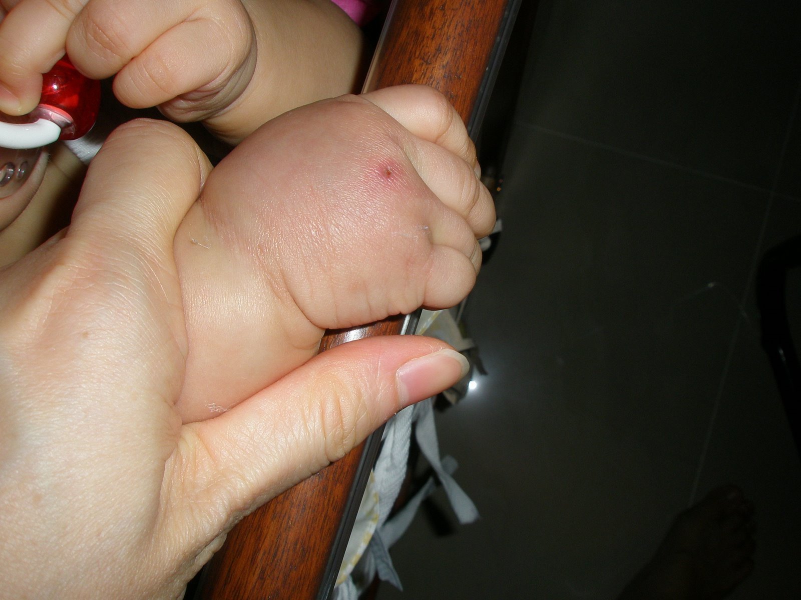 [Cass+in+hosp,+Cass]