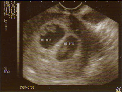 ultrasounds at 8 weeks. He performed an ultrasound and