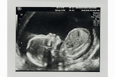 عکس سونوگرافی گلاریس در هفته 18 بارداری