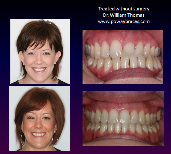 List 100+ Pictures Mara Appliance Before And After Photos Completed