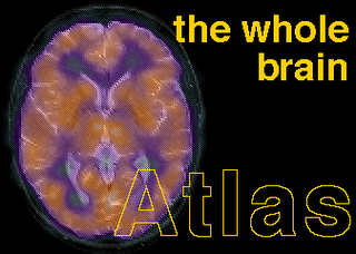 The Whole Brain MRI & CT Atlas THE+WHOLE+BRAIN+ATLAS