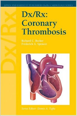 Dx/Rx Coronary Thrombosis (Dx/Rx Cardiology Series)  Coronary+thrombosis