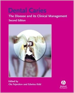 Dental Caries: The Disease and Its Clinical Management DENTAL+CARIES