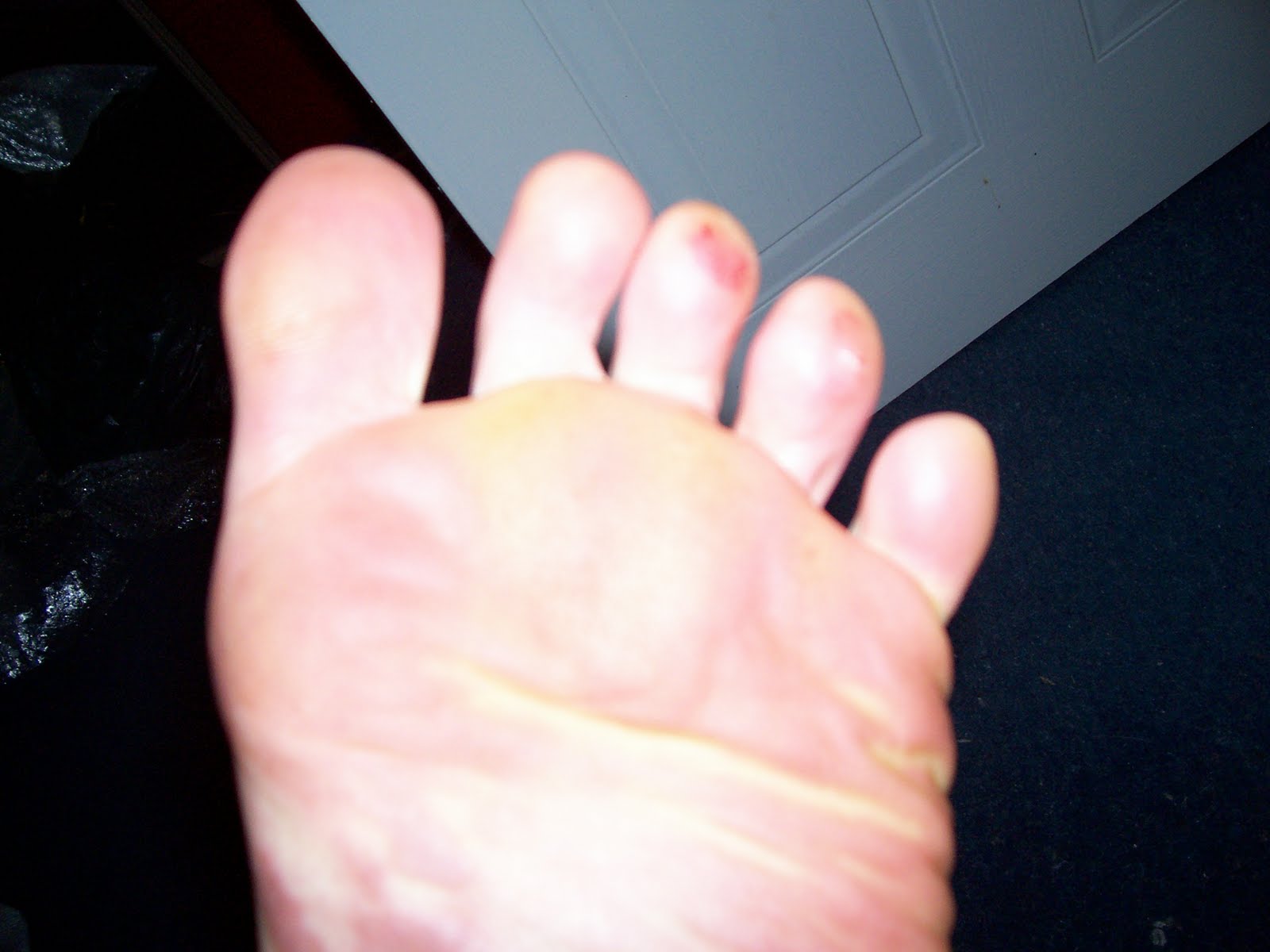 La Curée A guide for the surgical spirit perplexed