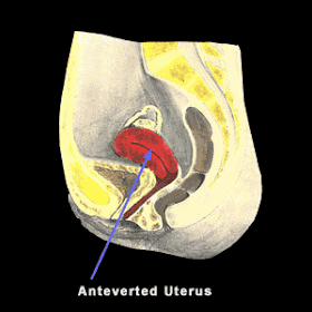 My Little World What Is Introvert Or Retroverted Uterus