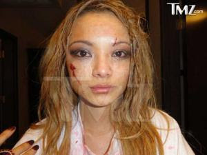 Tila Tequila Attacked Video