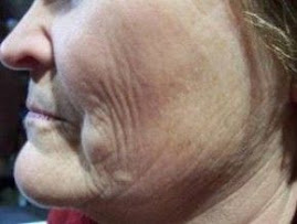 CHECK OUT MARSHA LEVINE'S RESULTS WITH GLIMPSE!