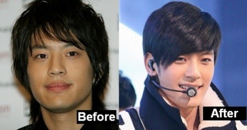 Kpop"Music Of My Life": [Pics] Artis Korea Yang Operasi Plastik