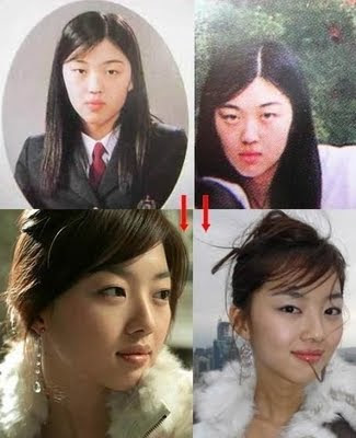 Korean Plastic Surgery on Cosmetic Surgery  Korea  Kingdom Of Plastic Surgery