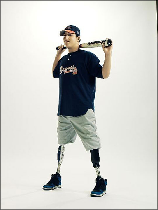 [ProstheticBase.jpg]