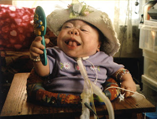 Severely Affected System: