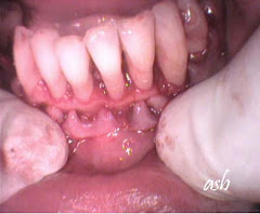 Periodoncia.