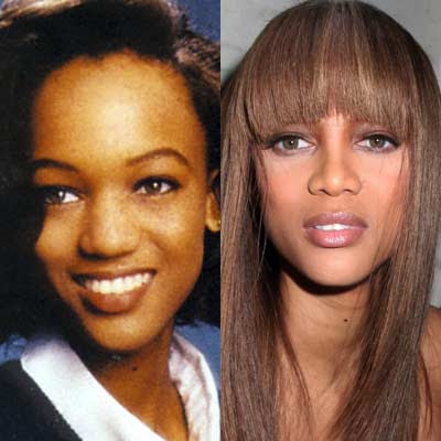 Nose Plastic Surgery on Celebs Before And After Nose Plastic Surgery   36 Pics   Curious