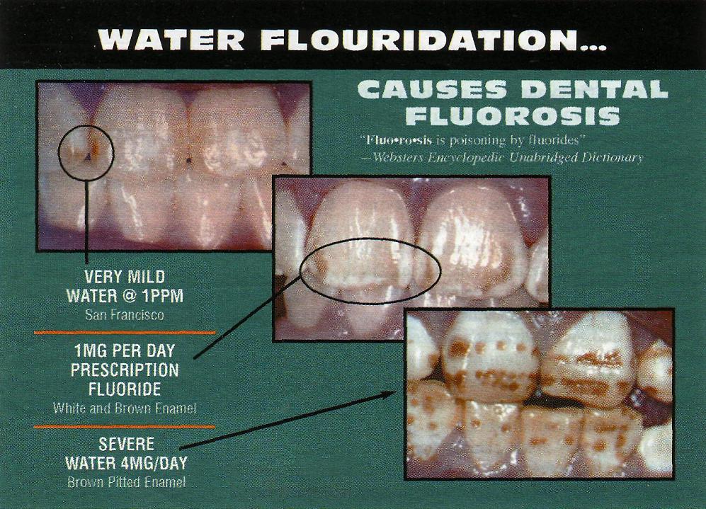 [ΦΘΟΡΙΩΣΗ+8.JPG]