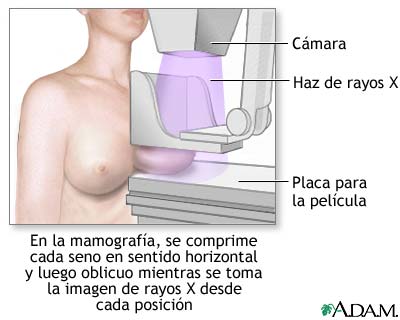 [mamografia.jpg]
