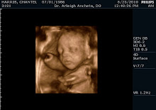 Jamal at 29 weeks