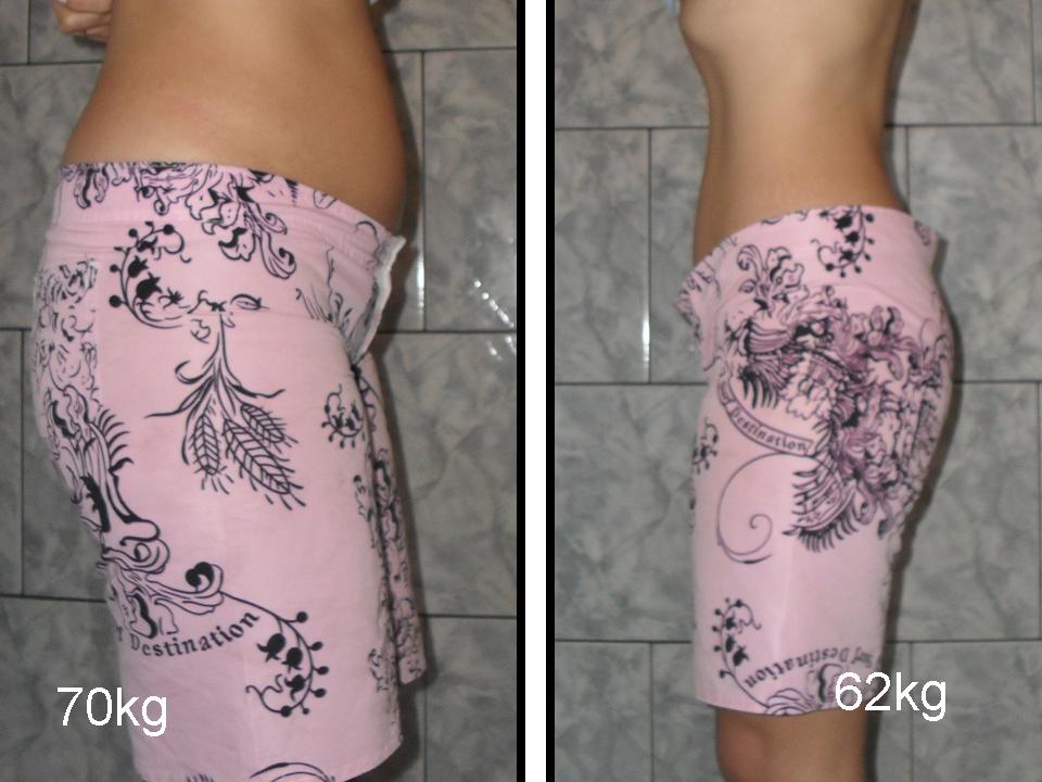 Antes E Depois Da Corrente Russa